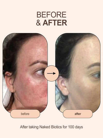 Get Naked Starter-Kit